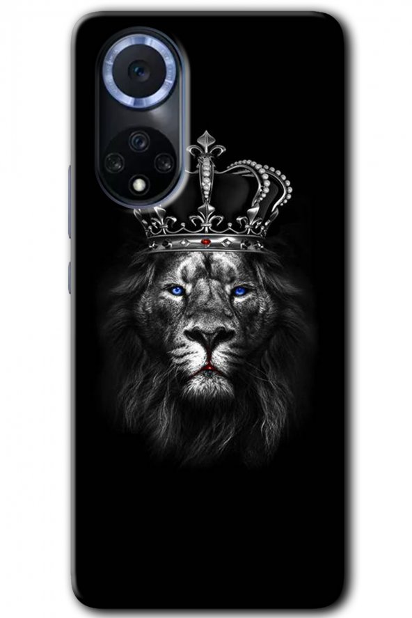 Huawei Nova 9 Kılıf HD Desen Baskılı Arka Kapak - King Lion